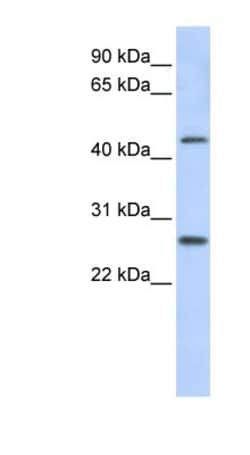 PRAMEF10 Antibody, Novus Biologicals:Antibodies:Primary Antibodies