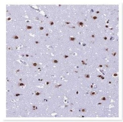 PRAME Family Member 12 Antibody, Novus Biologicals 25 &mu;L, Unlabeled:Antibodies,