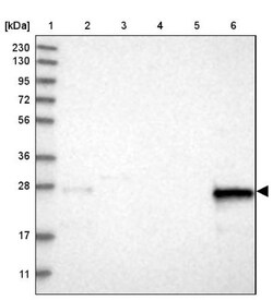 PRAT4B/CNPY4 Antibody, Novus Biologicals 0.1mL; Unlabeled:Antibodies, Polyclonal