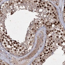 PRC1 Antibody, Novus Biologicals 25 &mu;L; Unlabeled:Antibodies, Polyclonal