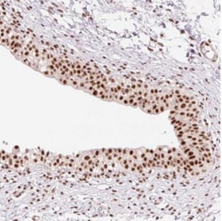 PRDM11 Antibody, Novus Biologicals 0.1mL; Unlabeled:Antibodies, Polyclonal