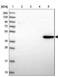 PRDM12 Antibody, Novus Biologicals 0.1mL; Unlabeled:Antibodies, Polyclonal
