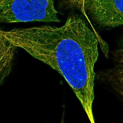 GTPBP2 Antibody, Novus Biologicals:Antibodies:Primary Antibodies