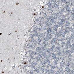 PRDM6 Antibody, Novus Biologicals 0.1mL; Unlabeled:Antibodies, Polyclonal