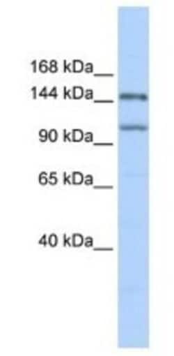 PRDM9 Antibody, Novus Biologicals 0.05mg; Unlabeled:Antibodies, Polyclonal