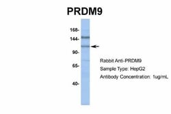 PRDM9 Antibody, Novus Biologicals 0.05mg; Unlabeled:Antibodies, Polyclonal
