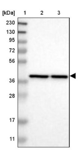 PREB Antibody, Novus Biologicals:Antibodies:Primary Antibodies
