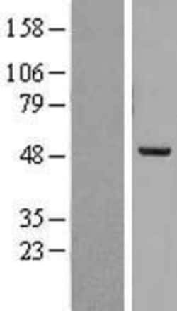 Novus Biologicals&trade;&nbsp;PREB Overexpression Lysate