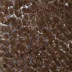 PREB Antibody, Novus Biologicals 0.1mL; Unlabeled:Antibodies, Polyclonal