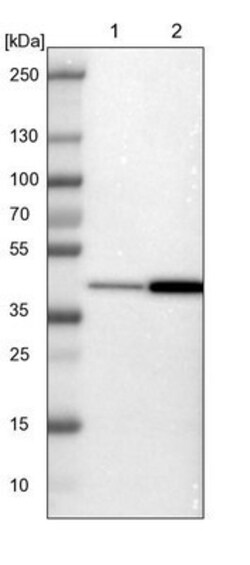 PREB Antibody, Novus Biologicals 0.1mL; Unlabeled:Antibodies, Polyclonal