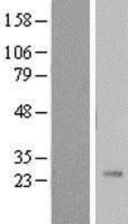 Novus Biologicals&trade;&nbsp;Pregnancy specific beta 1 glycoprotein 11 Overexpression Lysate