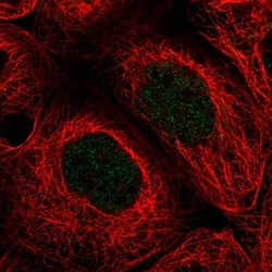 Pregnancy specific beta 1 glycoprotein 11 Antibody, Novus Biologicals 25