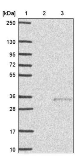 Pregnancy specific beta 1 glycoprotein 11 Antibody, Novus Biologicals 25