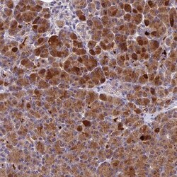 Pregnancy Zone Protein Antibody, Novus Biologicals 25 &mu;L; Unlabeled:Antibodies,
