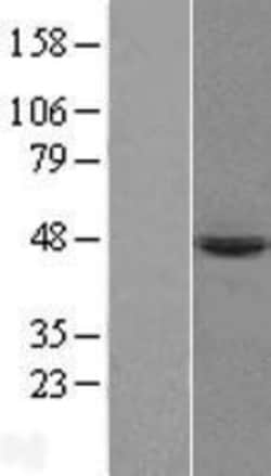 Novus Biologicals&trade;&nbsp;PRELP Overexpression Lysate