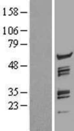 Novus Biologicals&trade;&nbsp;pre-mRNA cleavage factor I (59 kDa subunit) Overexpression Lysate