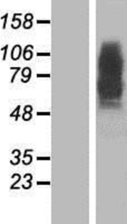 Novus Biologicals&trade;&nbsp;Presenilin-2 Overexpression Lysate