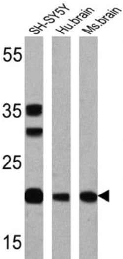 Presenilin-1 Antibody (APS 11), Novus Biologicals 0.2mg; Unlabeled:Antibodies,