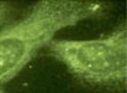 Presenilin-1 Antibody (APS 11), Novus Biologicals 0.2mg; Unlabeled:Antibodies,