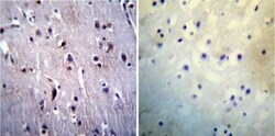 Presenilin-1 Antibody (APS 11), Novus Biologicals 0.2mg; Unlabeled:Antibodies,