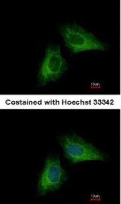 Presenilin-1 Antibody, Novus Biologicals 0.1mL; Unlabeled:Antibodies, Polyclonal