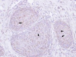 Presenilin-1 Antibody, Novus Biologicals 0.1mL; Unlabeled:Antibodies, Polyclonal