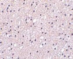 Presenilin-1 Antibody - BSA Free, Novus Biologicals 0.1mg; Unlabeled:Antibodies,