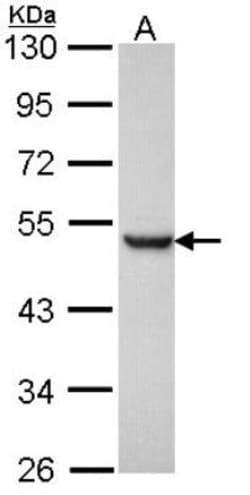 Presenilin-1 Antibody, Novus Biologicals 0.1mL; Unlabeled:Antibodies, Polyclonal
