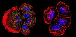 Presenilin-2 Antibody (APS 21), Novus Biologicals 0.2mg; Unlabeled:Antibodies,