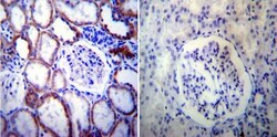 Presenilin-2 Antibody (APS 21), Novus Biologicals 0.2mg; Unlabeled:Antibodies,