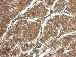 PRG2 Antibody, Novus Biologicals 0.1mL; Unlabeled:Antibodies, Polyclonal