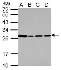 PRG2 Antibody, Novus Biologicals 0.1mL; Unlabeled:Antibodies, Polyclonal