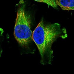 PRHOXNB Antibody, Novus Biologicals 0.1mL; Unlabeled:Antibodies, Polyclonal