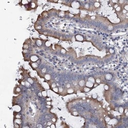 PRHOXNB Antibody, Novus Biologicals 0.1mL; Unlabeled:Antibodies, Polyclonal