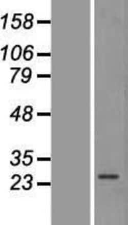 Novus Biologicals&trade;&nbsp;AMPK beta 2/PRKAB2 Overexpression Lysate