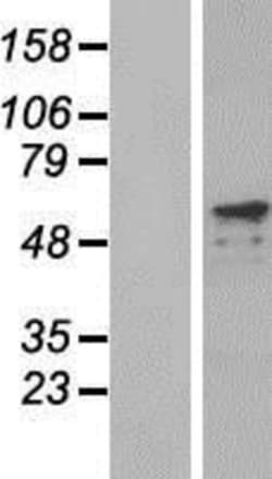 Novus Biologicals&trade;&nbsp;PRKAG2 Overexpression Lysate