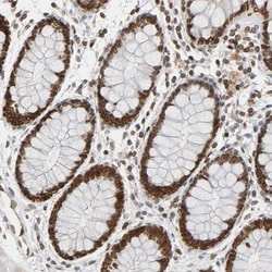 PRKAG2 Antibody, Novus Biologicals:Antibodies:Primary Antibodies