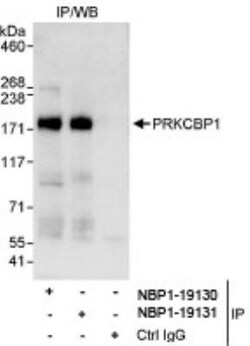 PRKCBP1 Antibody, Novus Biologicals 0.1mL; Unlabeled:Antibodies, Polyclonal