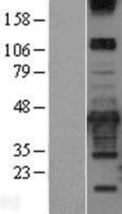 Novus Biologicals&trade;&nbsp;PRKCDBP Overexpression Lysate