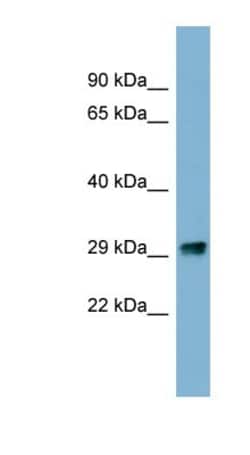 PRKRIP1 Antibody, Novus Biologicals:Antibodies:Primary Antibodies