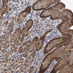PRKRIP1 Antibody, Novus Biologicals 0.1mL; Unlabeled:Antibodies, Polyclonal
