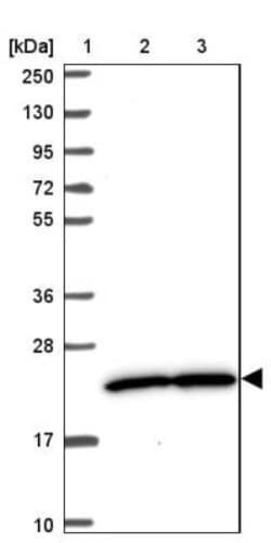 PRKRIP1 Antibody, Novus Biologicals 0.1mL; Unlabeled:Antibodies, Polyclonal