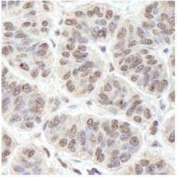 PRKRIR Antibody, Novus Biologicals 0.1mL; Unlabeled:Antibodies, Polyclonal