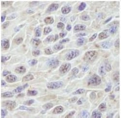 PRKRIR Antibody, Novus Biologicals 0.1mL; Unlabeled:Antibodies, Polyclonal