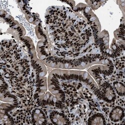 PRKX Antibody, Novus Biologicals:Antibodies:Primary Antibodies