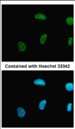 PRMT1 Antibody, Novus Biologicals 0.1mL; Unlabeled:Antibodies, Polyclonal