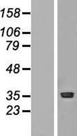 Novus Biologicals&trade;&nbsp;PRMT1 Overexpression Lysate