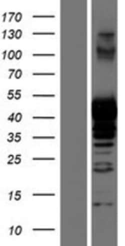 Novus Biologicals&trade;&nbsp;PRMT1 Overexpression Lysate