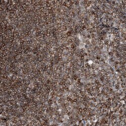PRMT10 Antibody, Novus Biologicals:Antibodies:Primary Antibodies