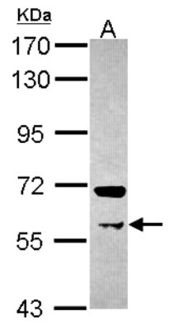 PRMT3 Antibody, Novus Biologicals 0.1mL; Unlabeled:Antibodies, Polyclonal